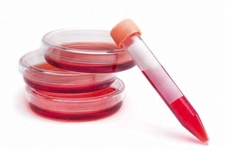 Beyaz Kan Düşüklüğü Nedenleri? Beyaz Kan Düşüklüğü Nedenleri?