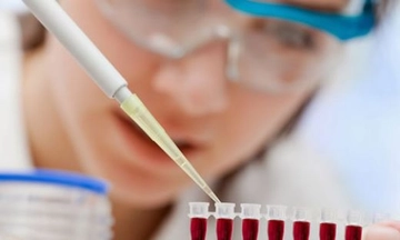 Kan Tahlili Wbc Yüksekliği Nedir?