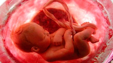 Kan Uyuşmazlığı Neden Olur ve Testi Nasıl Yapılır?