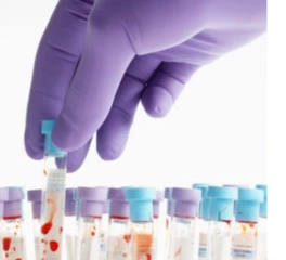 Tokluk Kan Şekeri Kaç Olmalı?